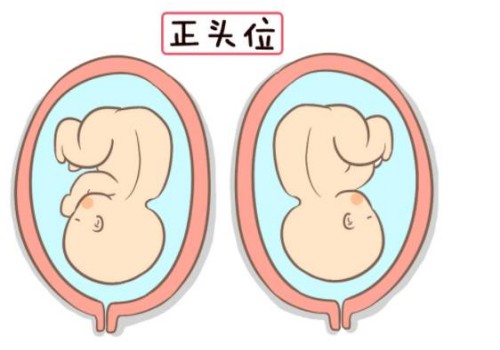 不长妊娠纹的孕妈都有这几个特征，你中了吗？