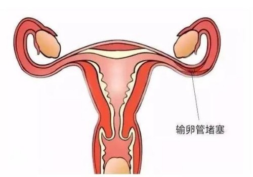 中医治疗巧囊有妙招，这两个治疗巧囊的方法记得收藏